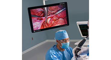 Monitor chirurgiczny Vividimage 4K